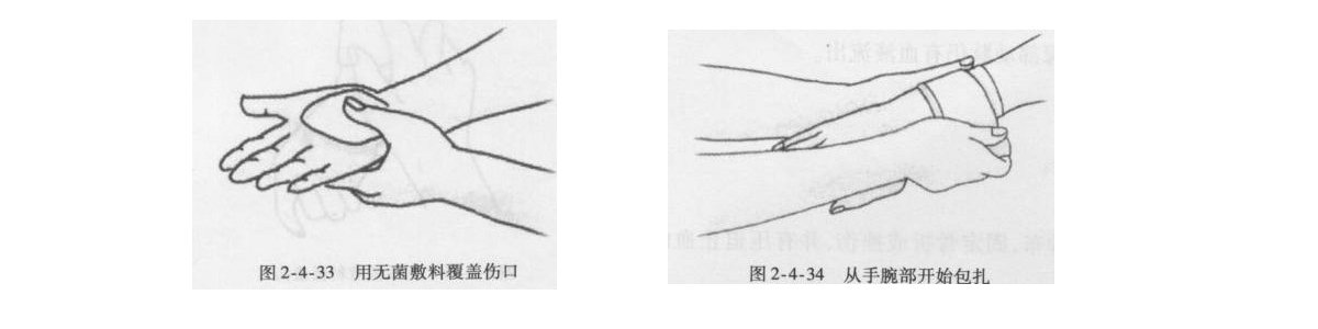 醫用繃帶8字包扎法.jpg